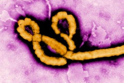ebola-virus-ePathram