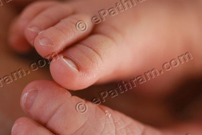 baby-feet-child-birth-ePathram