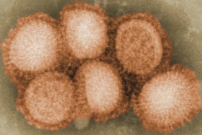 h1-n1-virus-spreading-in-kerala-ePathram